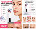 Pore Vacuum Blackhead Remover – Deep Clean in Seconds