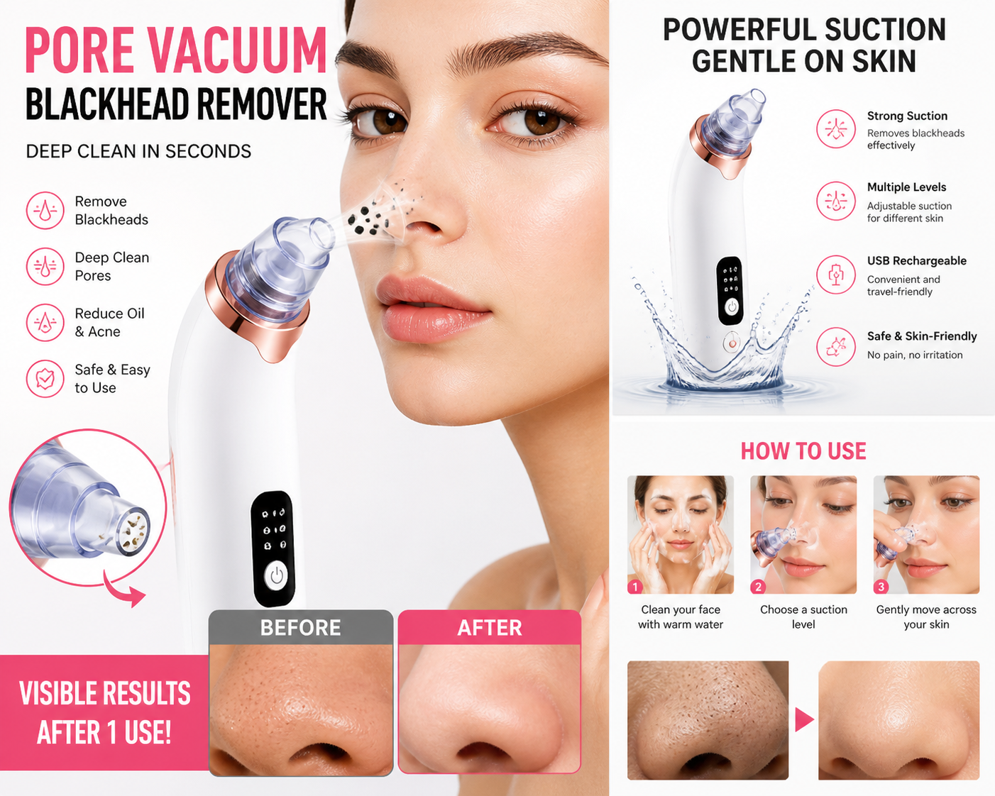 Pore Vacuum Blackhead Remover – Deep Clean in Seconds